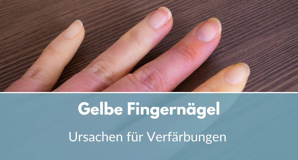 gelbe fingernägel ursachen