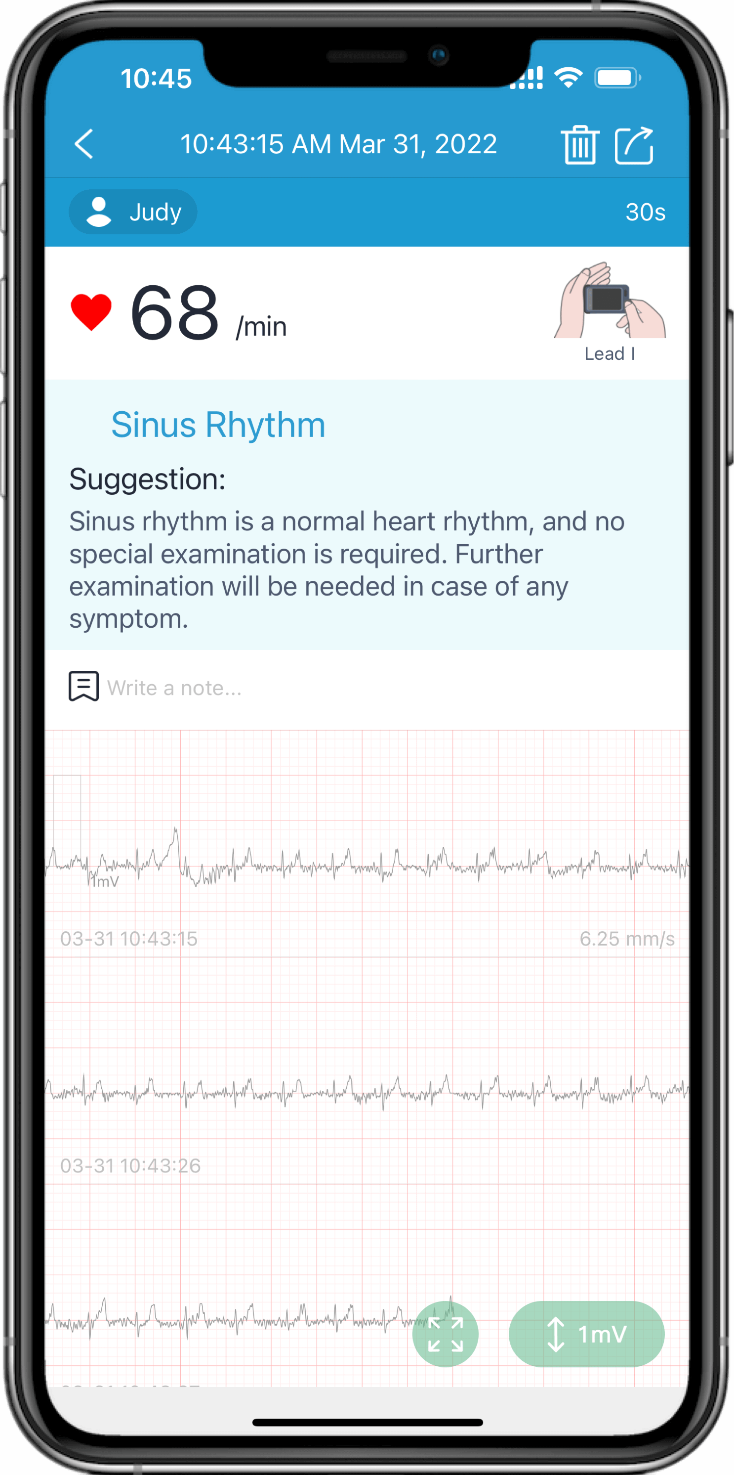detectar problemas cardíacos a través de la aplicación