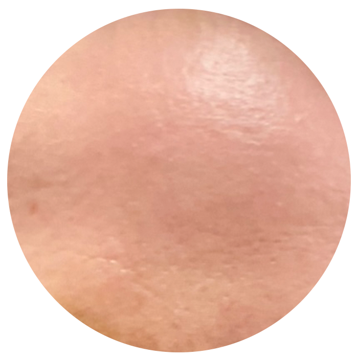 finer pores after taking the best collagen supplement singapore