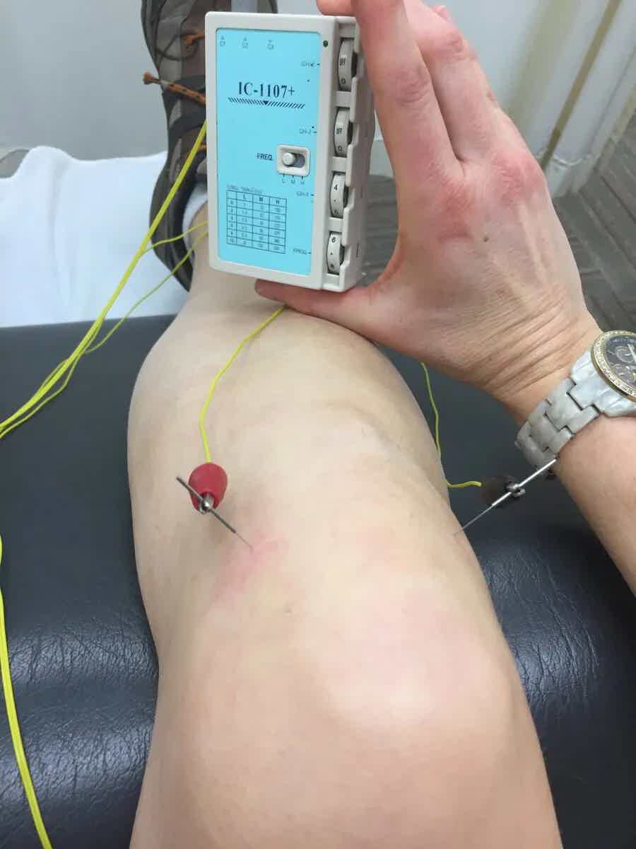 Healing From An Injury
