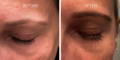 Nulastin Lash Serum Results Before After