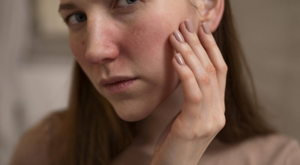 Skin Redness (Dermalogica Pro Calm)