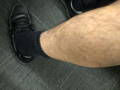Varicose Veins Relief Cream testimonials