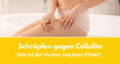schröpfen cellulite
