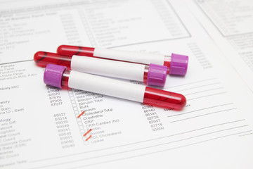 What is the Best SIBO Treatment Plan? -