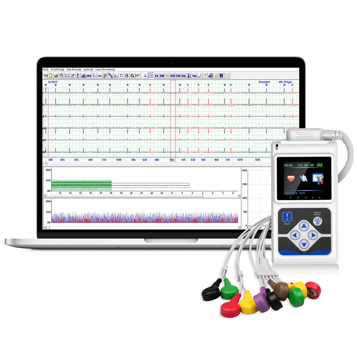 wellue 12-lead holter monitor with ai analysis