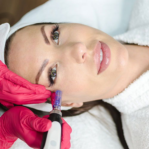 Micro needling