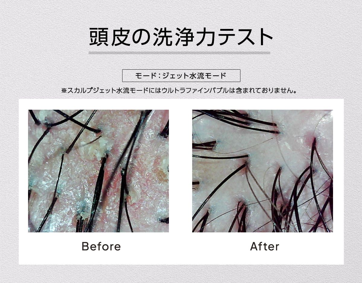頭皮の洗浄力テスト
