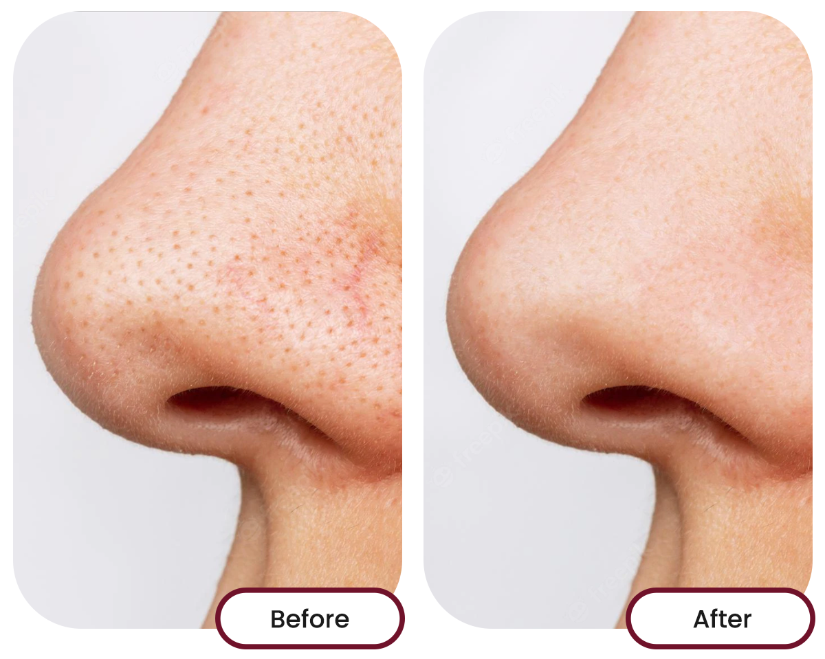 Before and after images of taking nano singapore's collagen drink