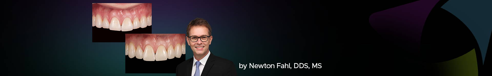 blog banner featuring Dr Newton Fahl and two clinical images behind him