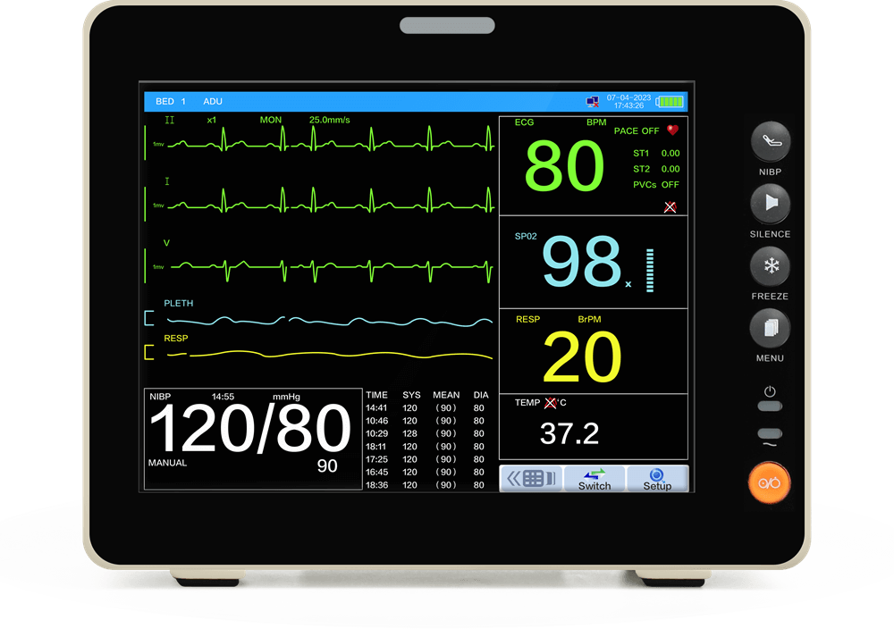8인치 터치스크린 환자 모니터의 nibp 보기