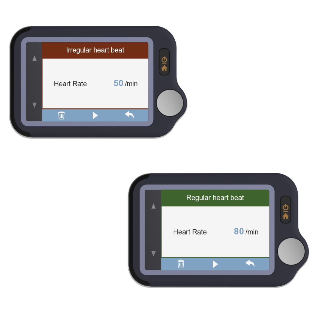 real-time ecg monitoring