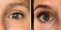 Nulastin Lash Serum Results Before After