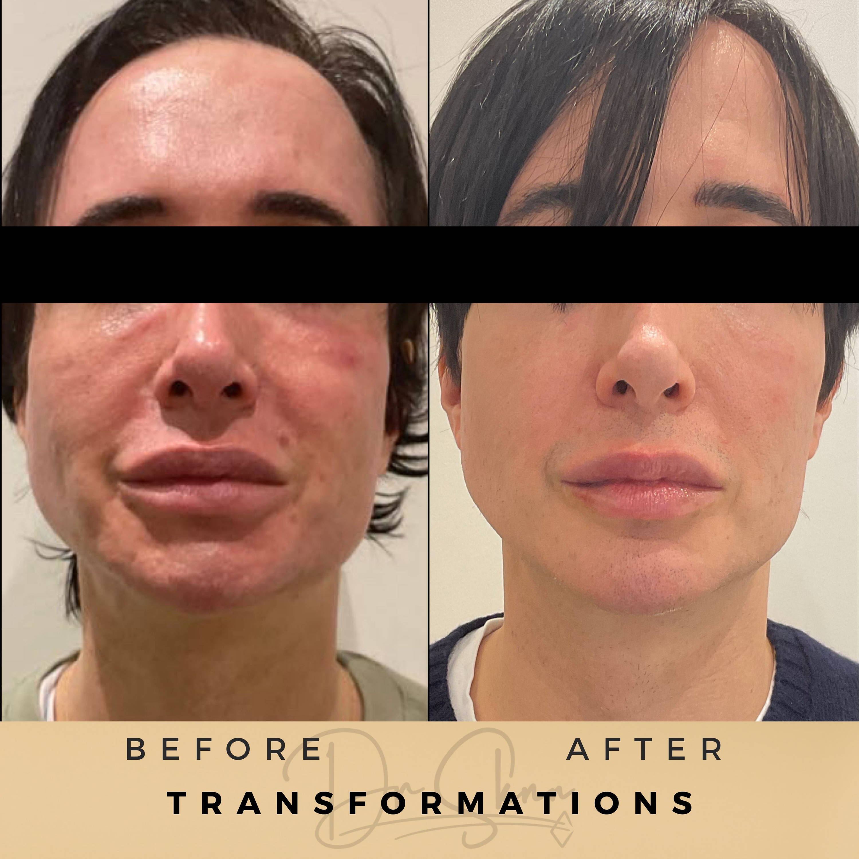 Aesthetic Clinic Wilmslow Transformation