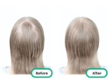 before and after of the top of a woman's head after using the best tea tree oil singapore