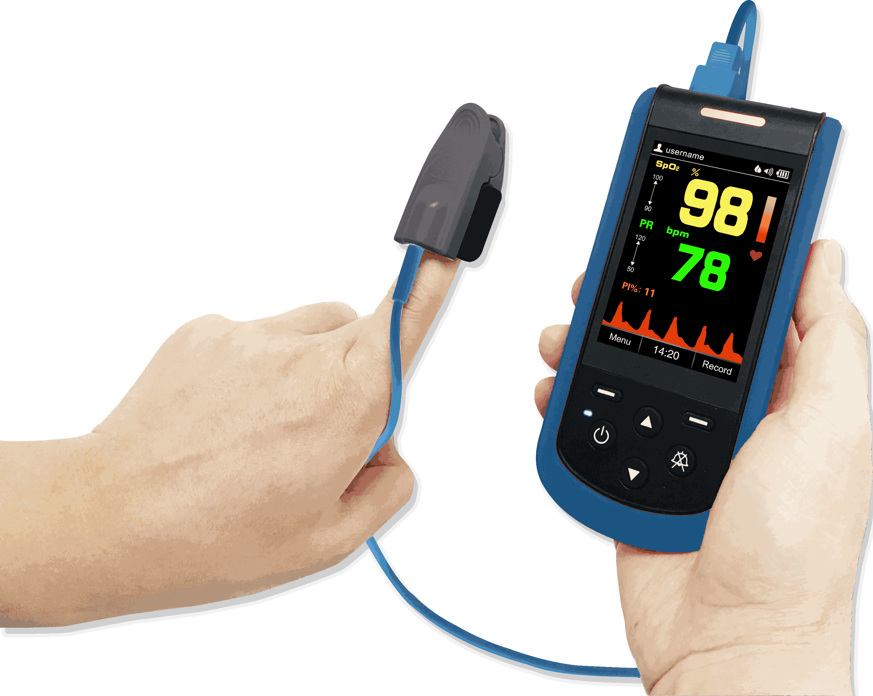 pulse oximeter to detect SpO2 and pulse rate