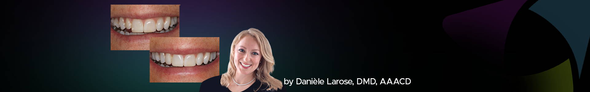 blog banner featuring Daniele Larosa and two clinical images