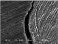 Figure1_Non-beveled direct composite restoration after 180 daysexhibiting a marginal gap in the cervical wall