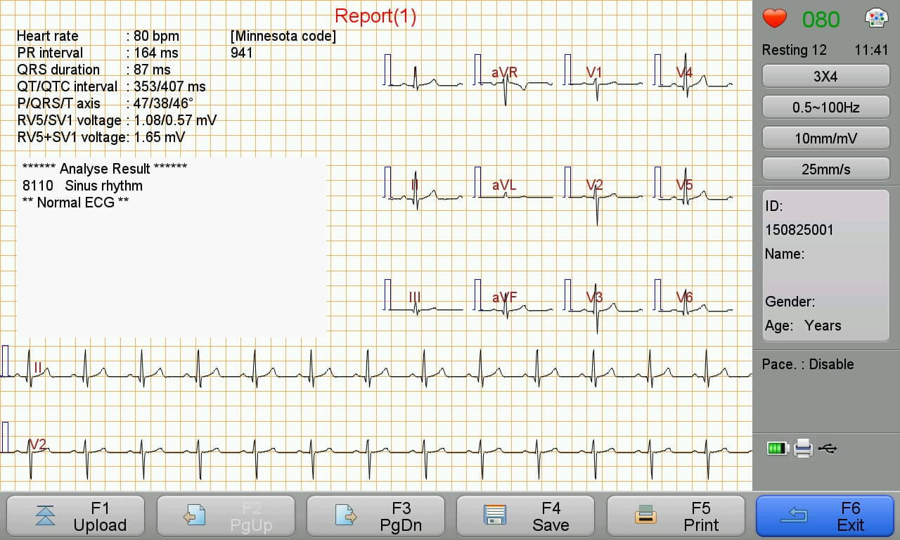 Vorschau des EKG-Berichts