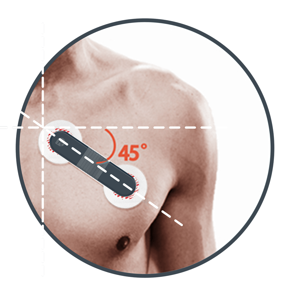 전극 패치가 있는 ECG 모니터 착용