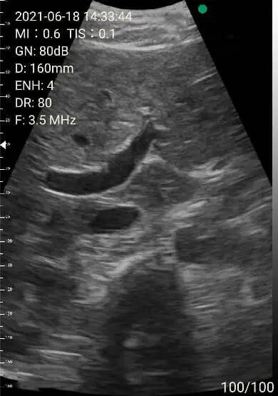 EagleView portable ultrasound image-portal area