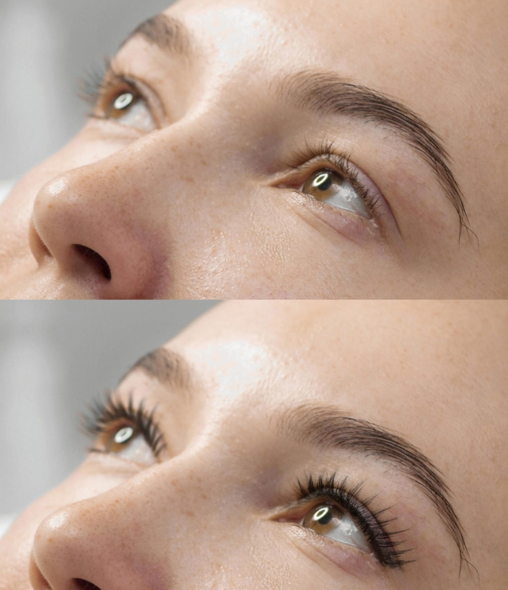 Lash Lift