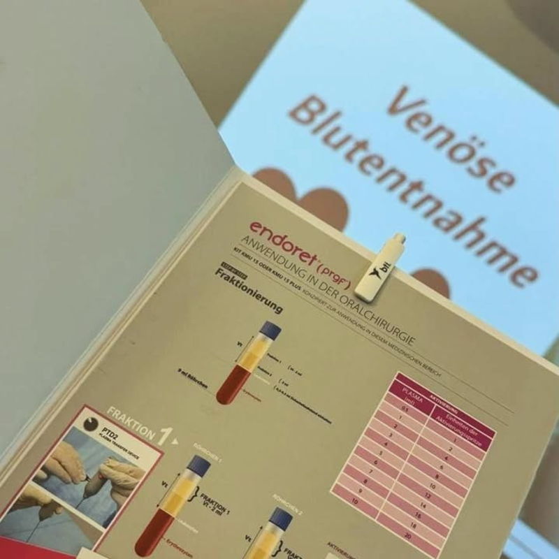 Habt ihr euch schon mal gefragt, was ein PRGF in der Zahnheilkunde ist? PRGF steht für “Plättchenreiches Fibrinklebeprotein” und wird aus dem eigenen Blut des Patienten gewonnen. Es wird verwendet, um die Heilung und Regeneration von Gewebe nach zahn