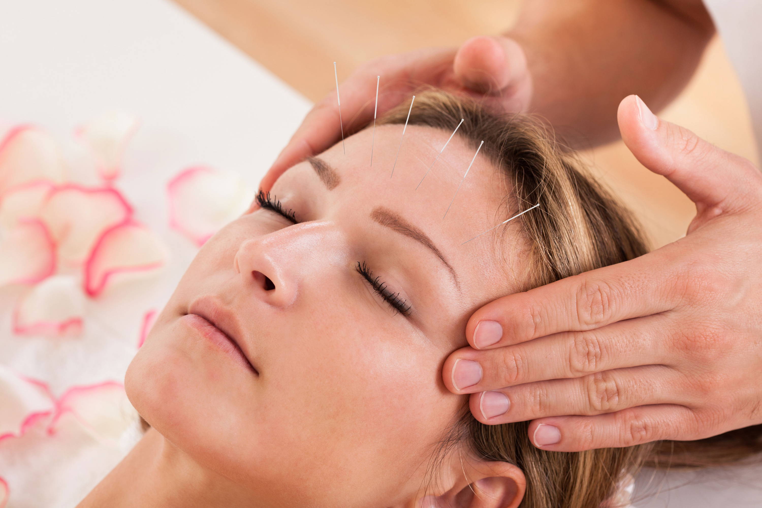 Can Acupuncture Help Ease Your Menopause Symptoms? – Eureka Wellbeing