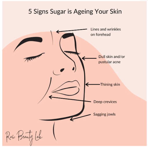 infographic shows the 5 signs that sugar is aging your skin