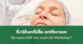 Krähenfüße entfernen - Ab wann hilft nur noch ein Mediziner?