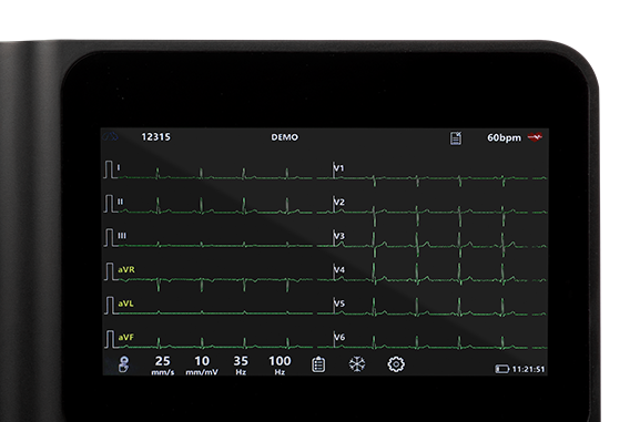 يحتوي جهاز تخطيط القلب البيطري على شاشة تعمل باللمس مع قلم لتوفير الطلبات المباشرة في ثوانٍ.