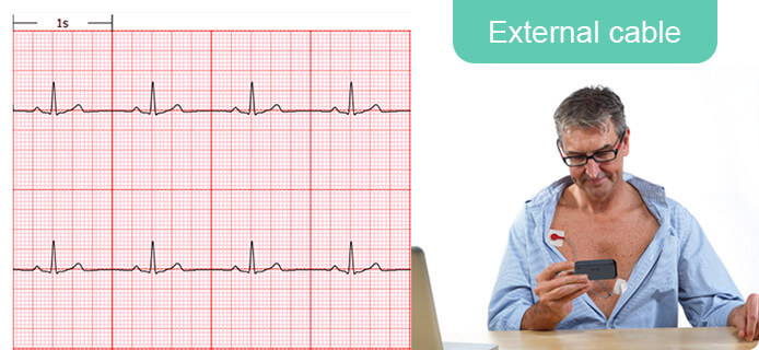Zeichnen Sie rauschfreies EKG mit externem Kabel auf