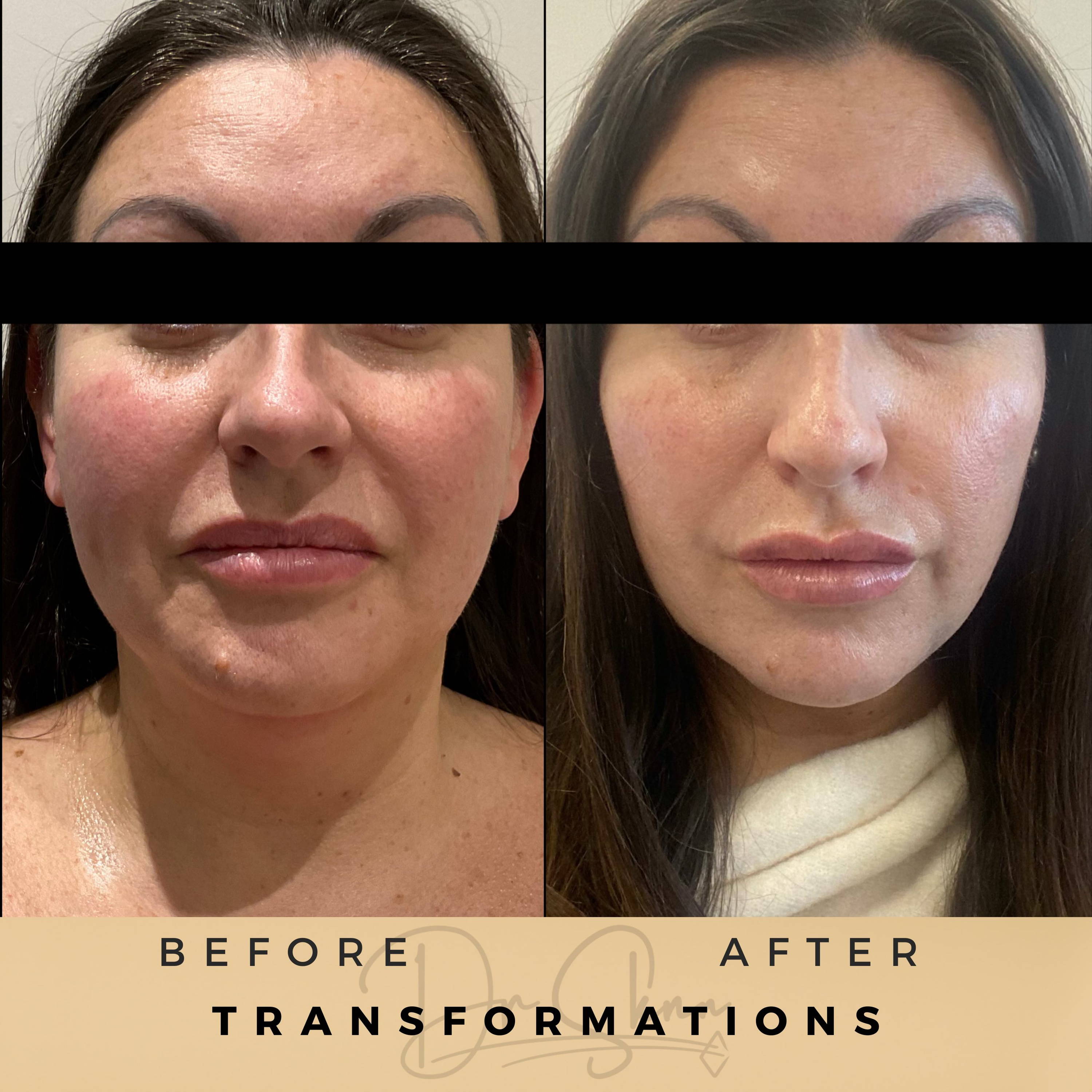 Transformations - Dr Sknn before and after