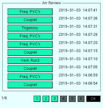 How to Use Arrhythmia Analysis (Review)