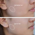 Before and after results of asian women using the spray for dermaplaning