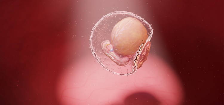 Embryotransfer: Ablauf, Erfolgsaussichten & Risiken  FERTILA
