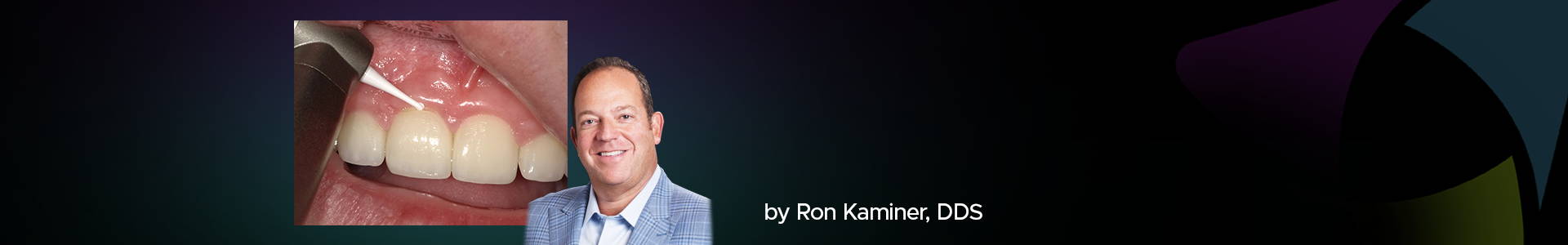 blog banner featuring Dr Ron Kaminer and a clinical image in the back