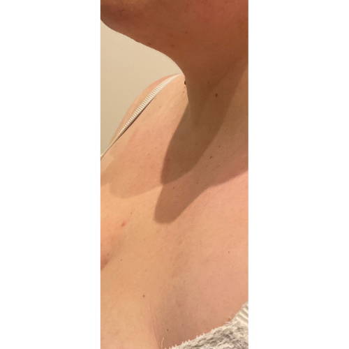 Dr Sknn Hydrachest After