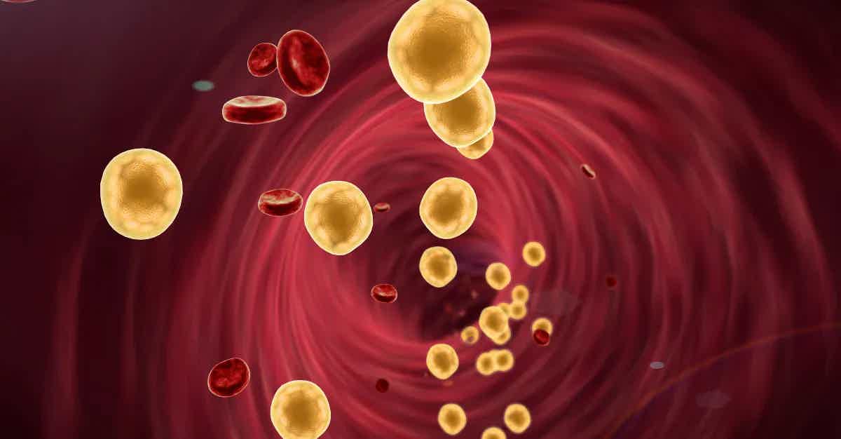 Taking Charge of Your Cholesterol Levels