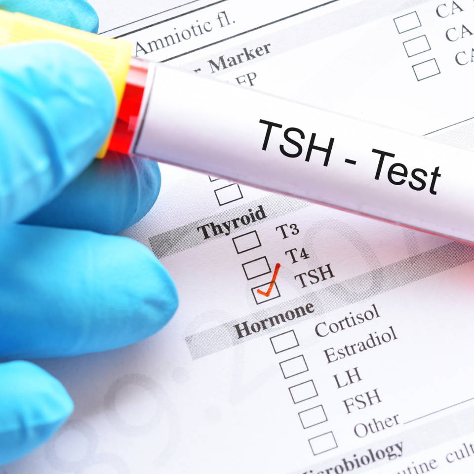 Blood sample labeled TSH Test with checklist for thyroid hormones.