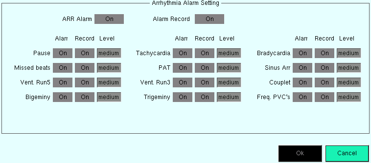 How to Configure Arrhythmia Analysis (Settings)