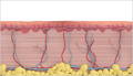 Thermal Diffusion Treatment