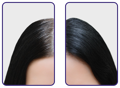 Hair and scalp improvement of a user of our best vitamins for hair growth