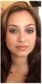 WunderHaut Anti-Aging Genius™ mit Radiofrequenz, LED Licht- und Mesotherapie, EMS und Elektroporation