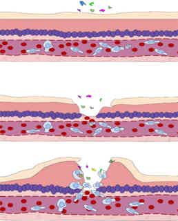 Injury leading to swelling