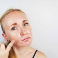 Woman looking upset pointing to her skin as it's dry.