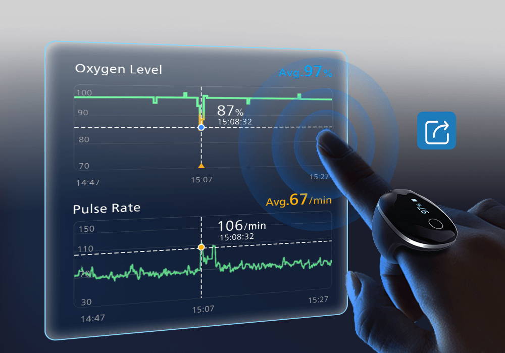 O2Ring-S pulse oximeter data report on screen showing oxygen level and pulse rate trends
