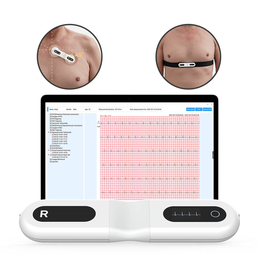 Monitor holter Wellue de 12 derivaciones con análisis de IA