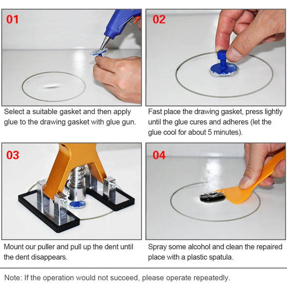 Dent Puller™ Paintless Dent Repair Kit – Vixily