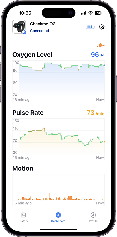 The history trend chart of SpO2, pulse rate, motion on app of Wellue Checkme O2 Max oxygen monitor. 